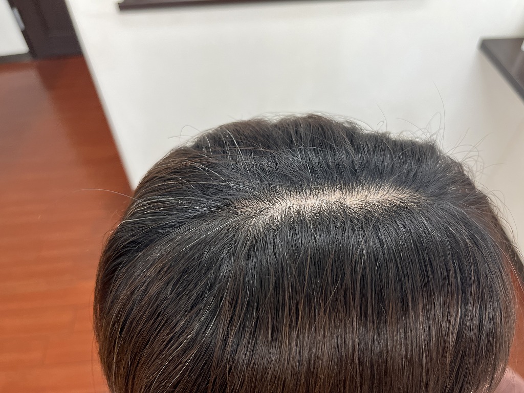 根元の伸びと白髪