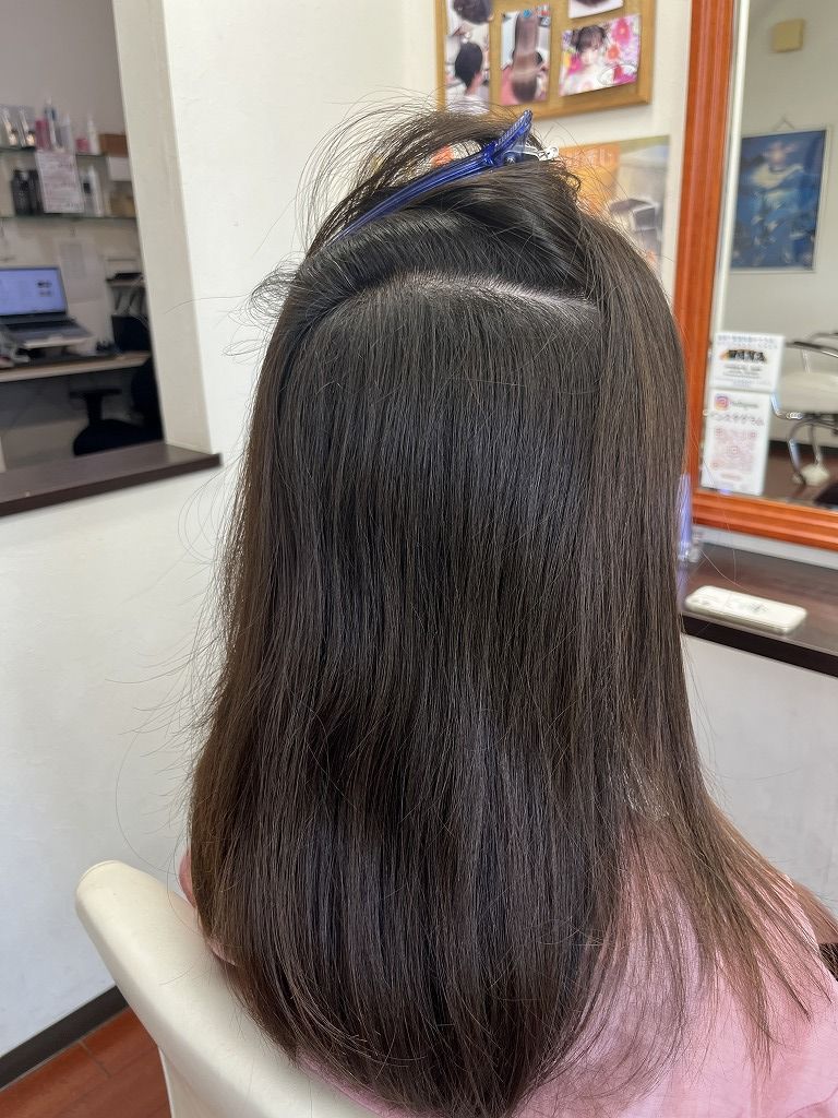 内側の波状毛