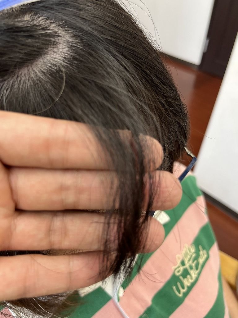 前髪の折れた部分