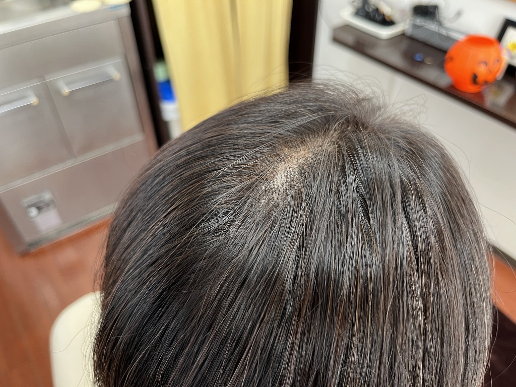 アフター　頭頂部　根元までしっかり染まっている様子