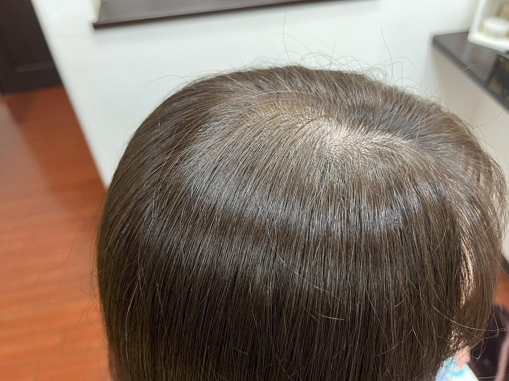 アフター:根元付近。色味が整いふんわり感もキープ