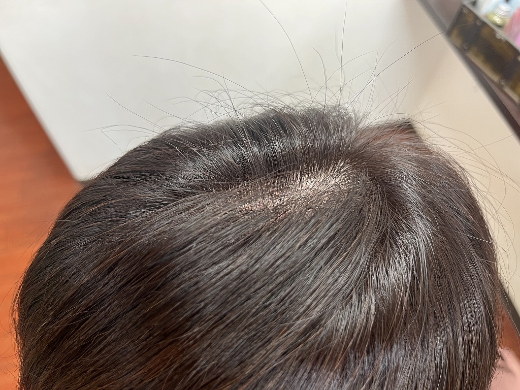 根元までしっかり染まったアフター写真