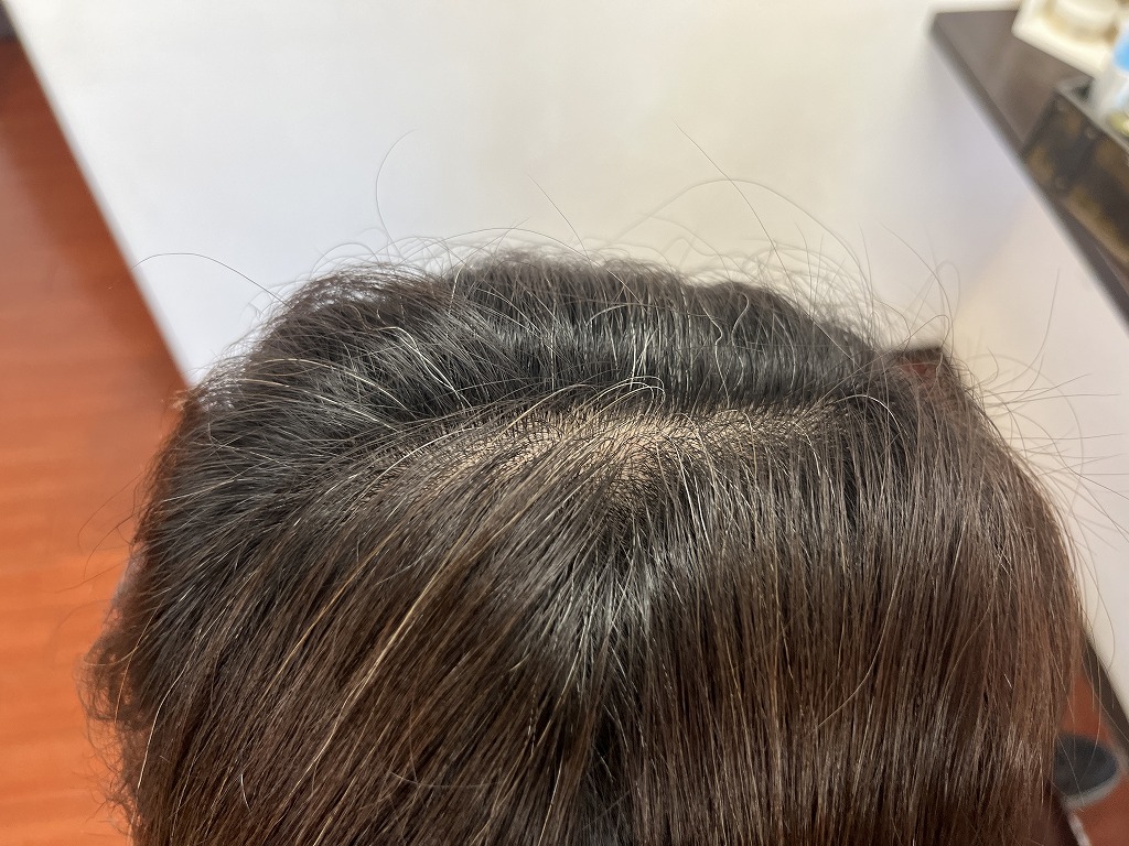 ビフォー根元 白髪が気になる状態