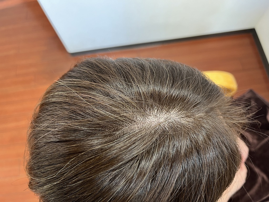 アフター根元 自然な白髪カバー