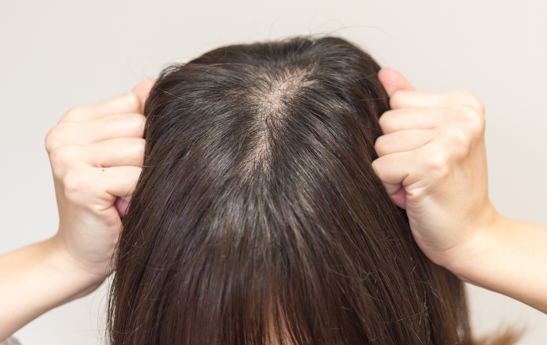 分け目のボリューム低下・細毛のイメージ