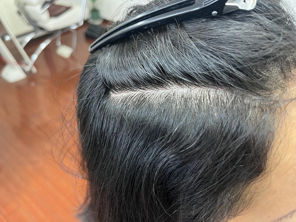 ビフォー：前髪のうねり。根元から強いクセで割れやすい