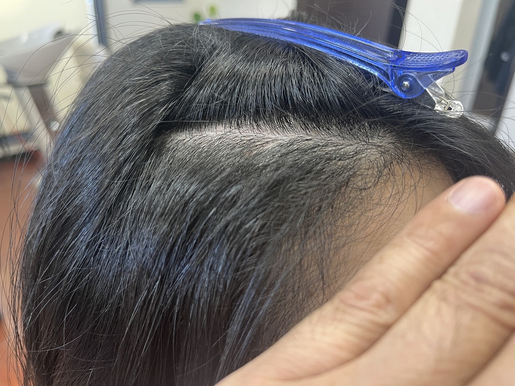 前髪の根元にうねりと広がりが出ているビフォー左側の状態