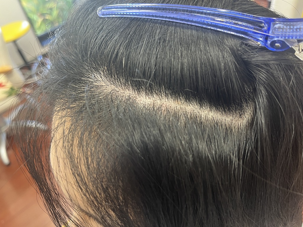 前髪の根元に捻じれがあり広がっているビフォー右側の状態