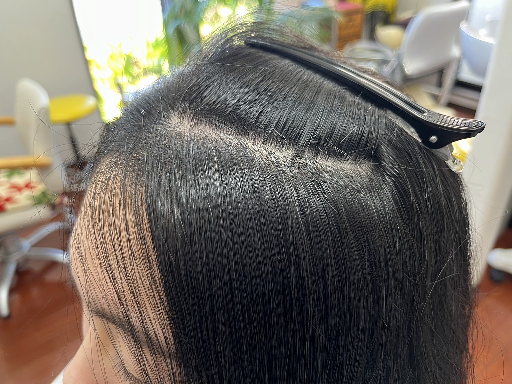 前髪の根元の捻じれがなくなりツヤが出たアフター右側の状態