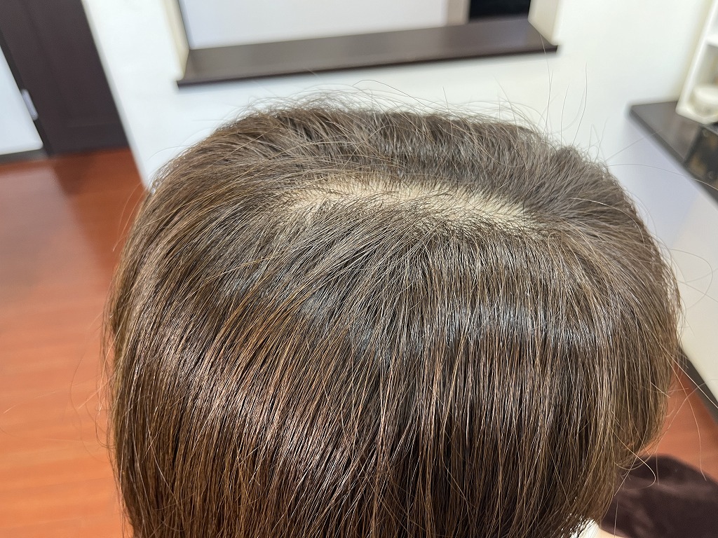 本庄市ヘアーリゾートアラック　ココアブラウンカラーのアフター根元の状態