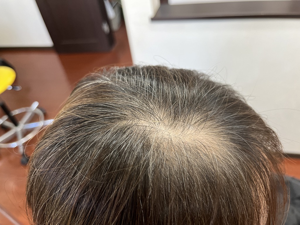 根元に白髪と褪色が見える細い髪質のビフォー状態