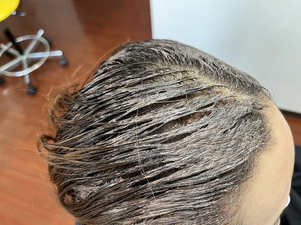 地肌につけないゼロテクで根元ギリギリにリタッチカラーを塗布している様子