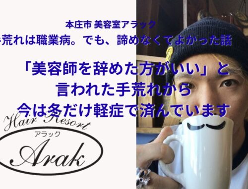 寒い季節の手荒れ問題｜美容師にとっては“仕事に直結する悩み