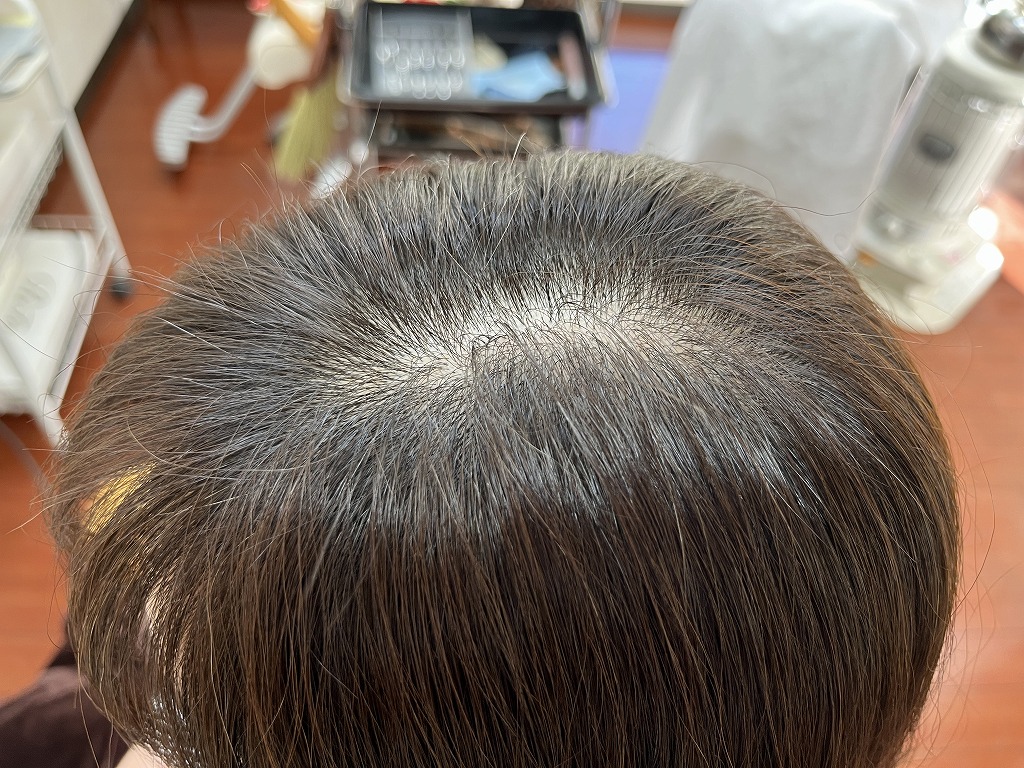 【アフター】リタッチカラー後の根元付近｜白髪がなじみ、根元の伸びが自然に整った仕上がり