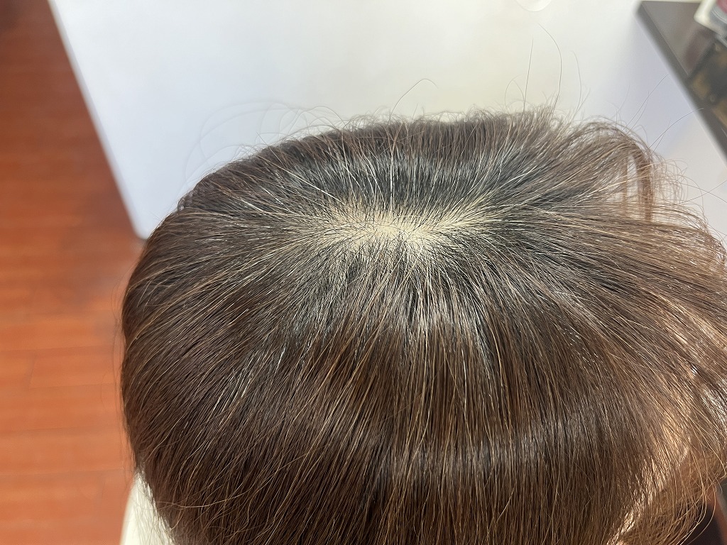 リタッチカラー施術前（根元）白髪が見えやすい部分