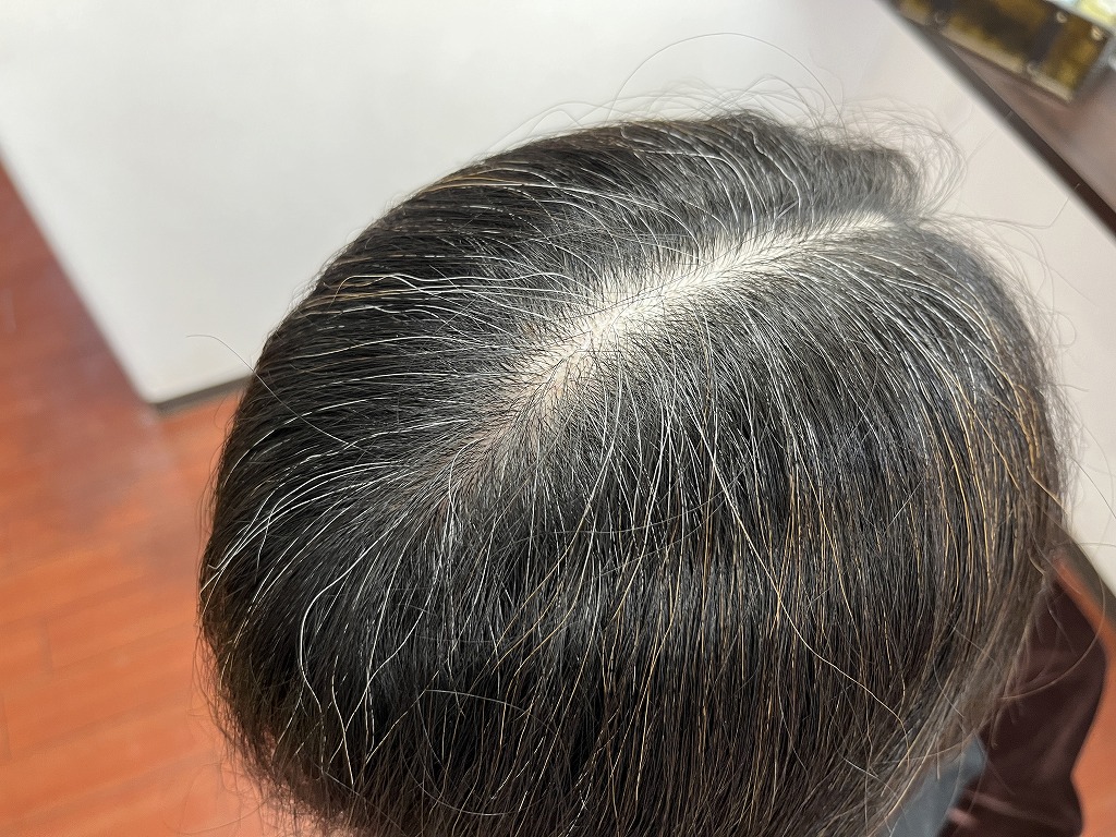 ハナヘナ2度染めのビフォー根元写真。分け目の白髪が気になる状態。