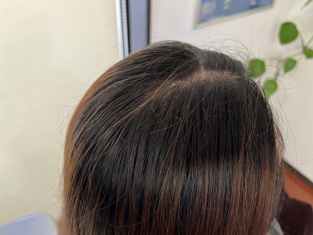 ビフォー根元:根元が伸びて色ムラが出やすい状態