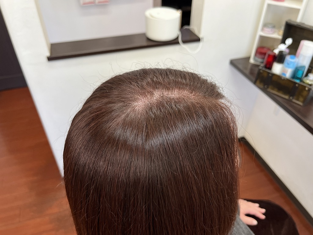 アフター根元:根元から整ってツヤが出た状態