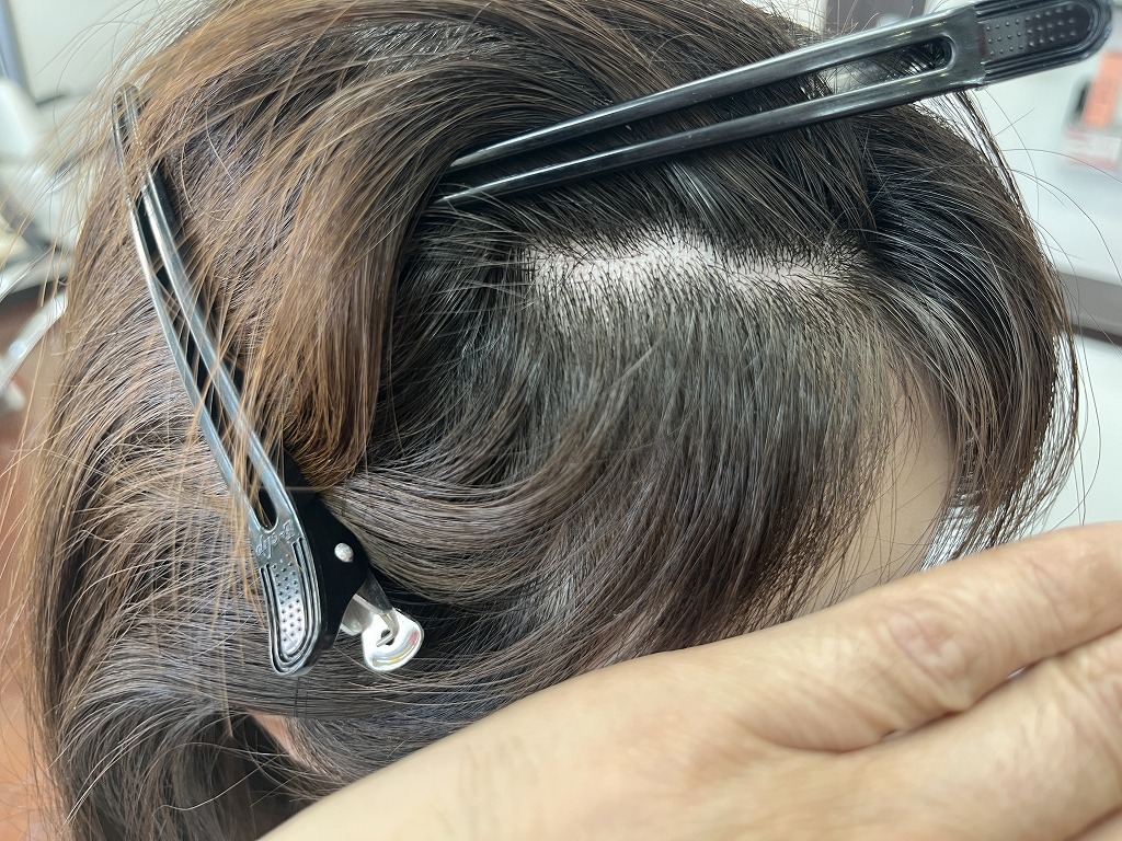 前髪の縮毛矯正とデジタルパーマ同時施術のビフォー前髪