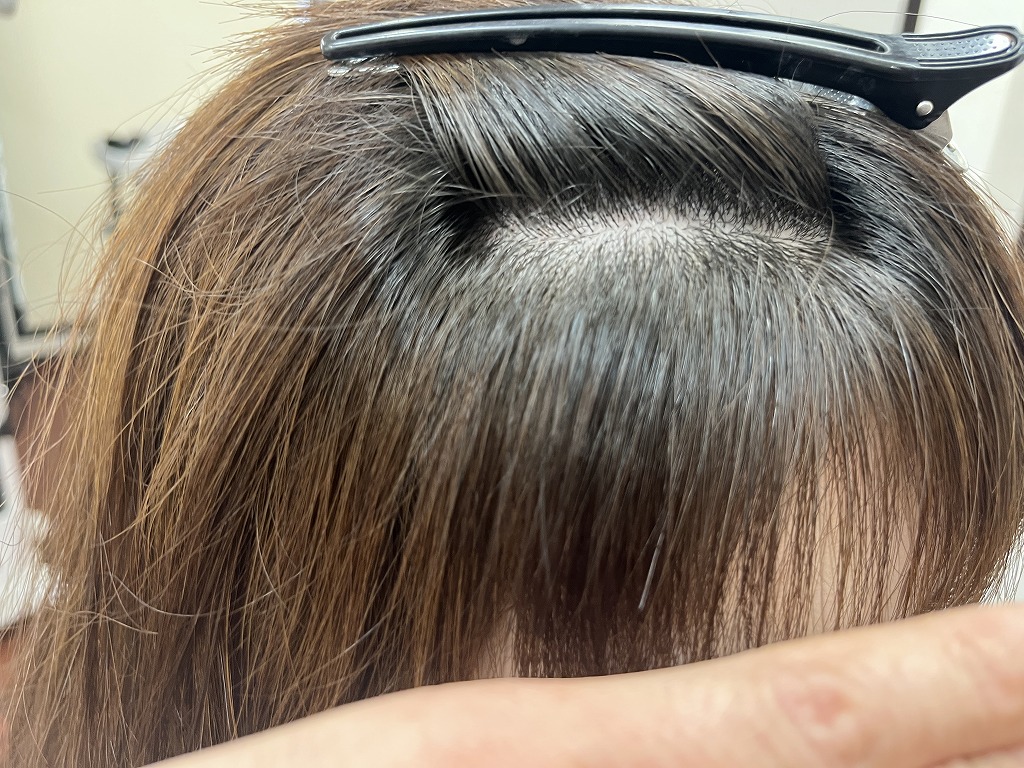 前髪の縮毛矯正とデジタルパーマ同時施術のアフター前髪