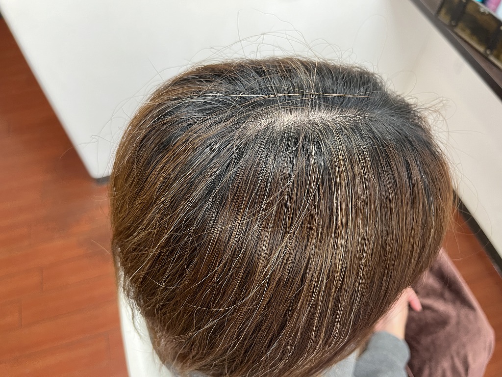 カットカラー施術前のトップの状態
