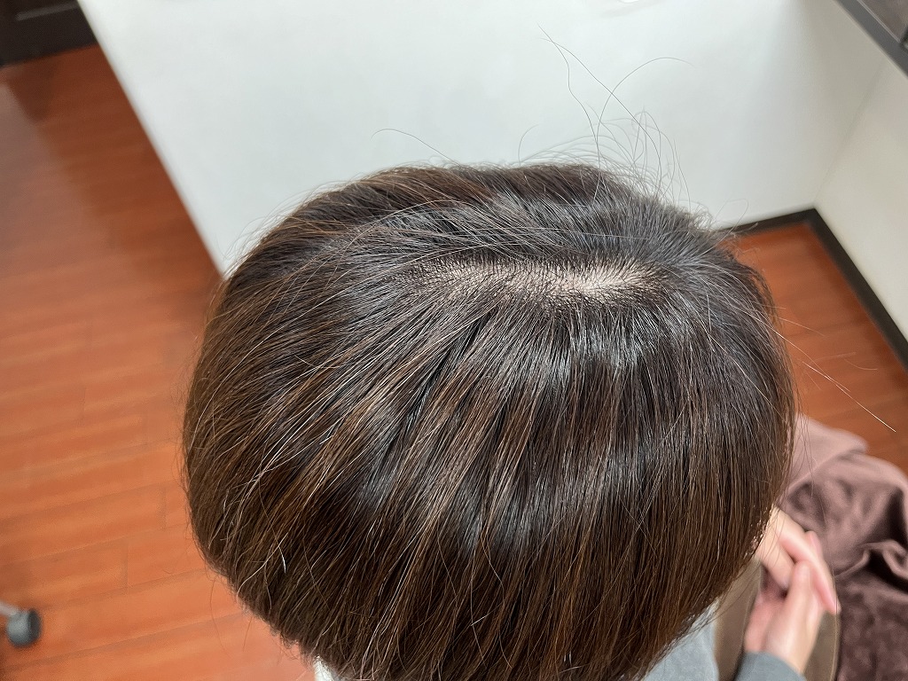 8Lvピンクベージュで仕上げたボブのトップ