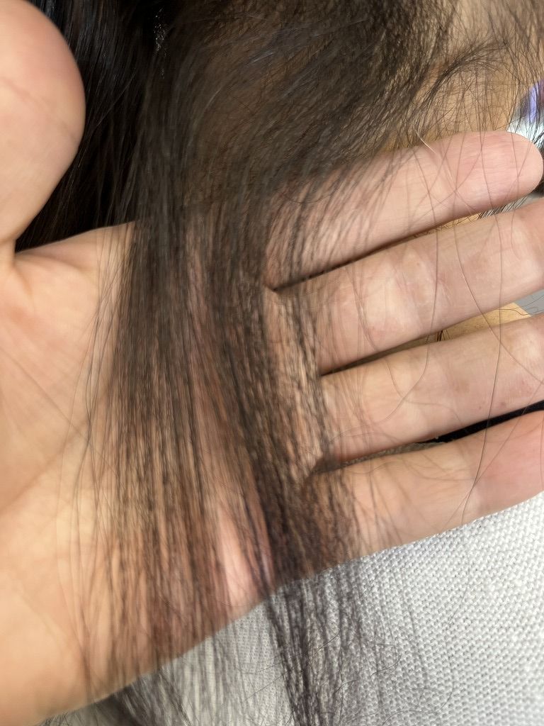 縮毛矯正のビフォー（襟足）｜縮毛レベルのチリつきが出ている状態