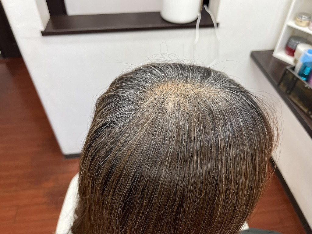 白髪が伸びた根元の状態