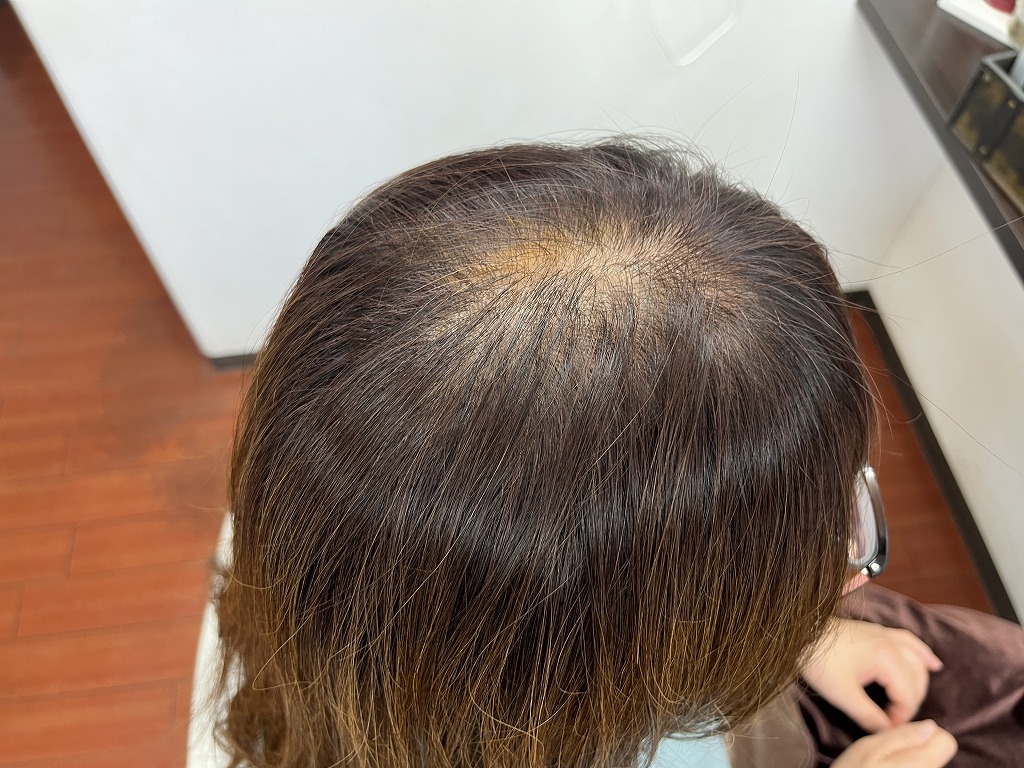 白髪染め施術後の根元の状態