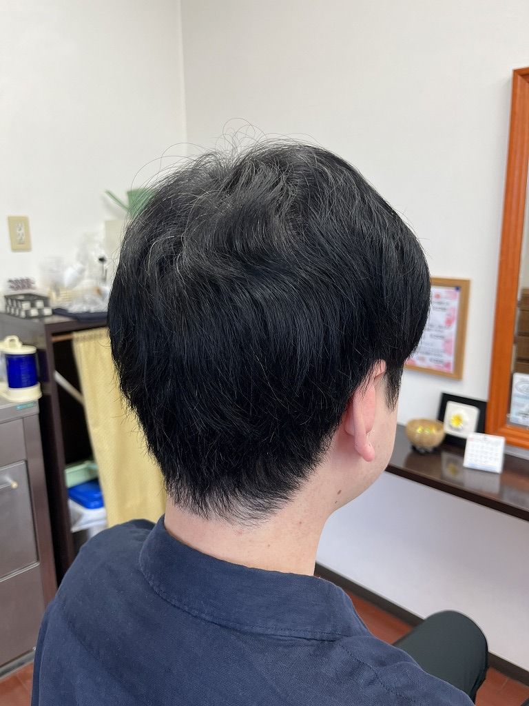 メンズ縮毛矯正の施術前。クセとゴワつきで髪がまとまりにくい状態