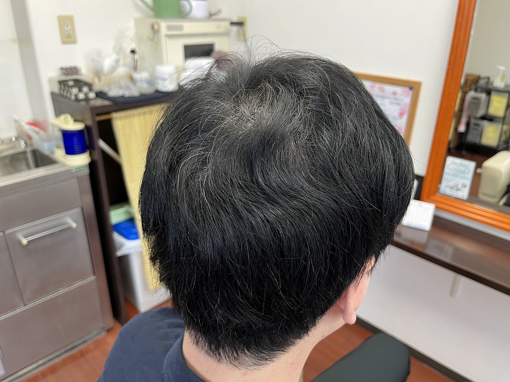 メンズ縮毛矯正のビフォー。後頭部にうねりと広がりが出ている状態