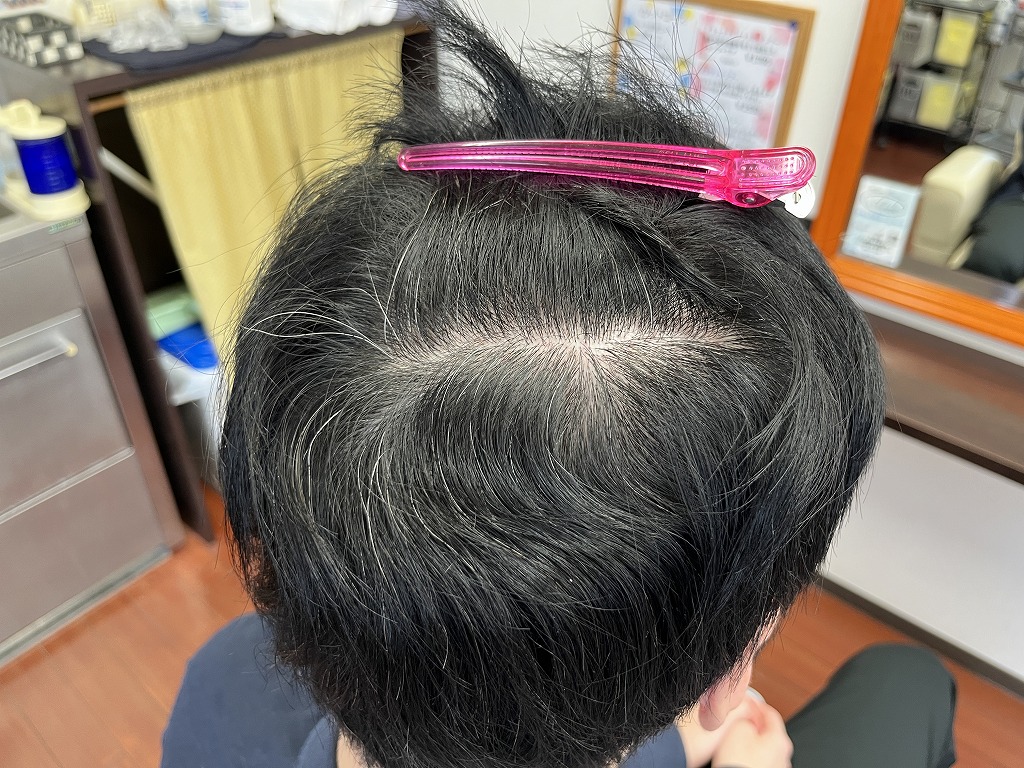 メンズ縮毛矯正のビフォー。内側のクセを確認している状態