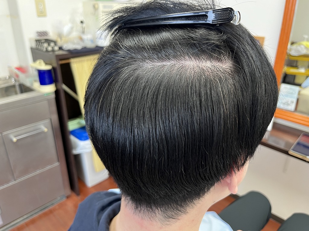 メンズ縮毛矯正のアフター。内側のクセが収まり乾かしただけでまとまりやすくなった状態