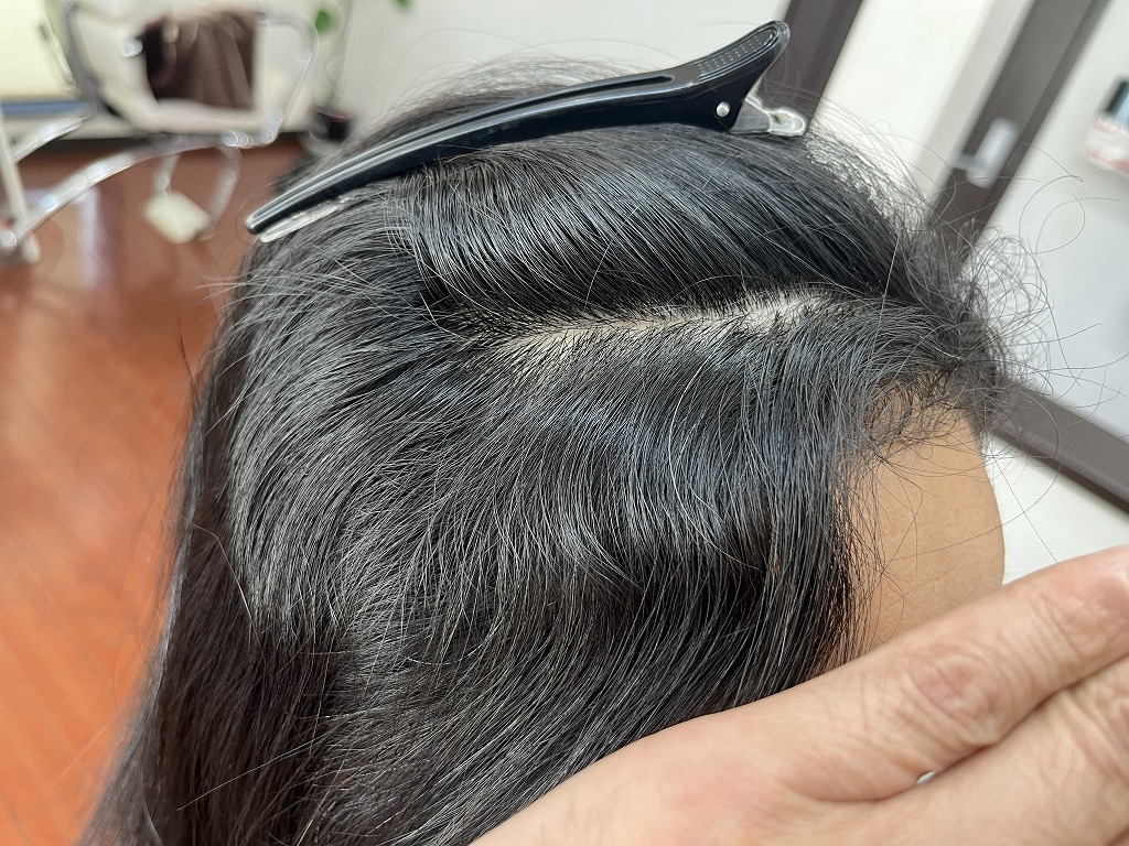 前髪付近の根元に強いクセが出ている縮毛矯正前の状態