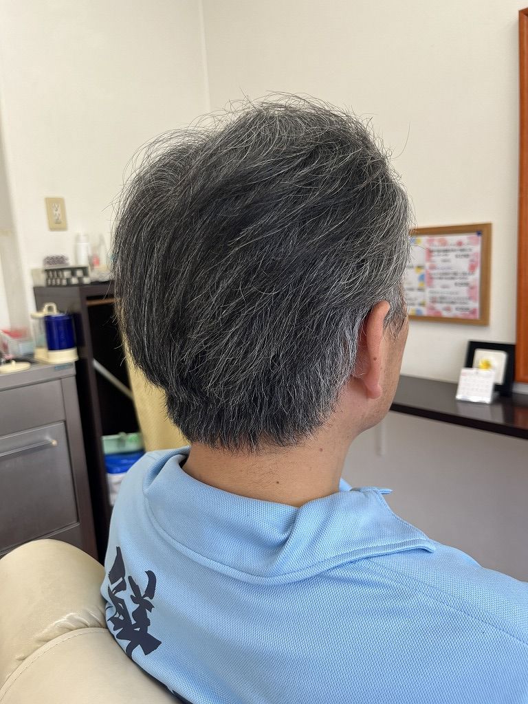 メンズプレミアムコースのビフォー
