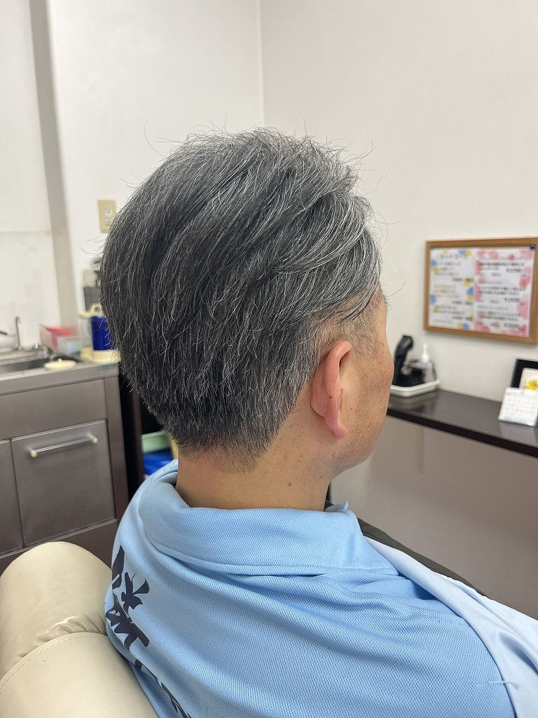 メンズプレミアムコースのアフター