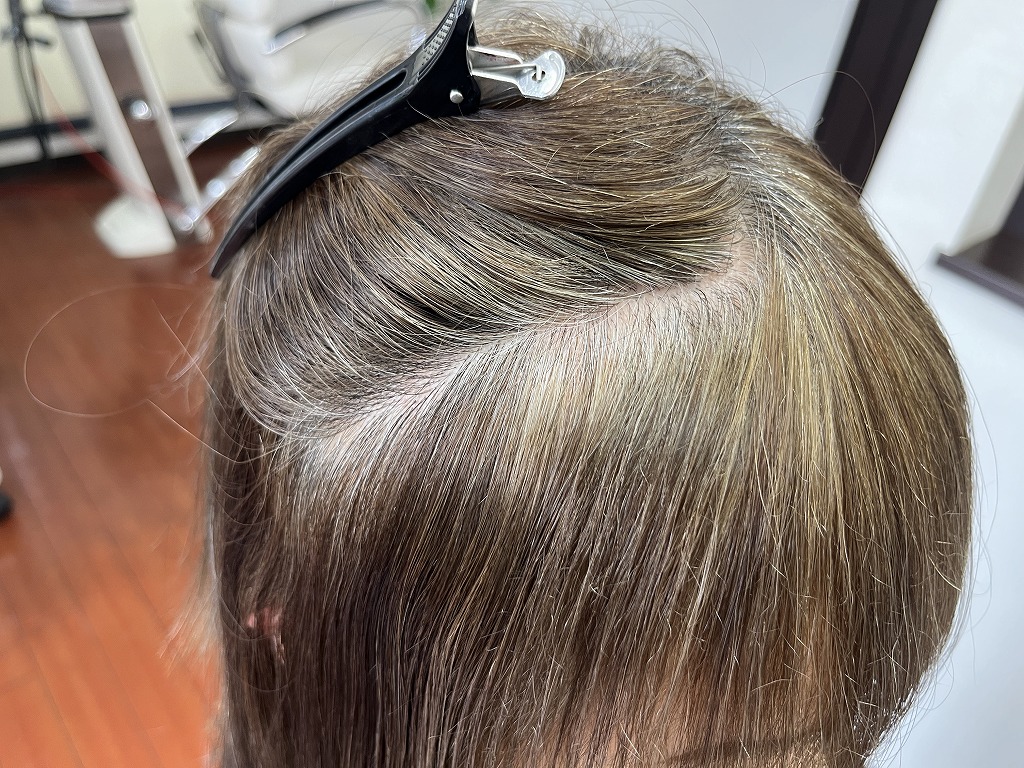 前髪部分の縮毛矯正後の仕上がり