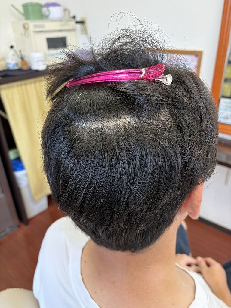 メンズショートの内側を分けて確認した根元のクセ。前回の縮毛矯正から4か月伸びた新生部