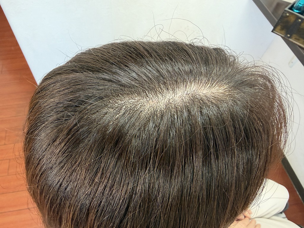 白髪染め後の根元の染まりを確認した状態