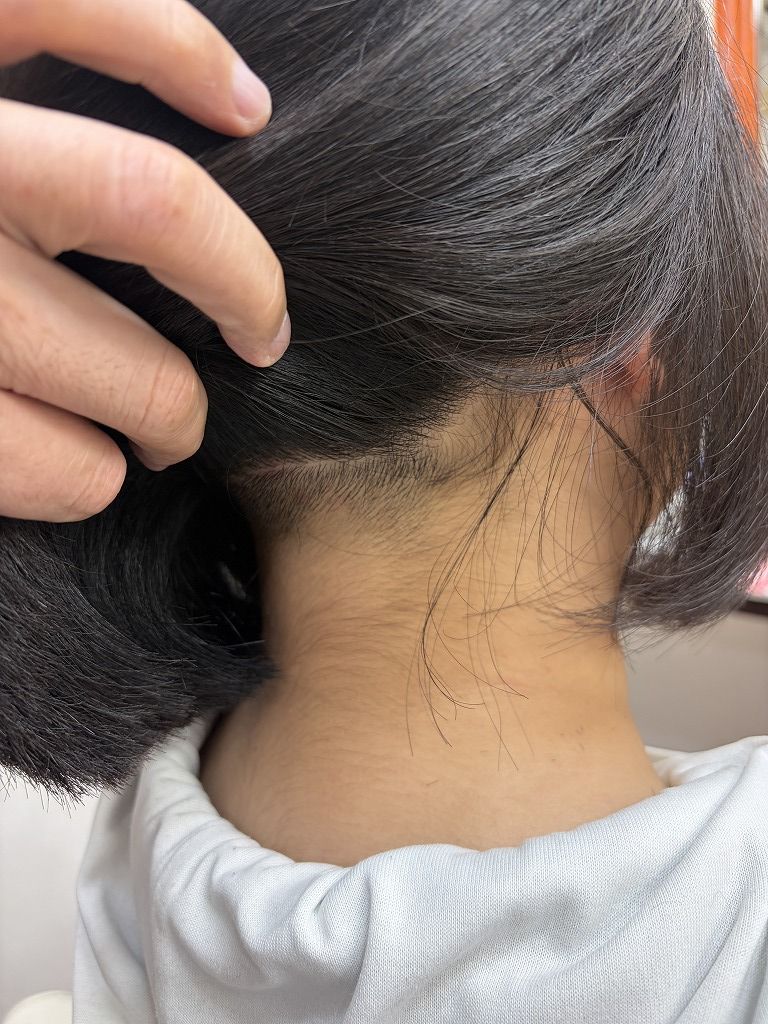 襟足の跳ね返りやすい生えグセをバリカンで短く処理した状態